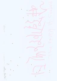 晒斑可以激光去除吗